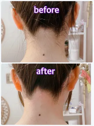 【痩身・脱毛サロン】 REBISKIN🌱のエステ・リラクイメージ