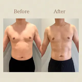 お腹痩せエステ Flat BELLY 恵比寿所属・【腸もみ/脂肪冷却】 お腹エステ/恵比寿のエステ・リラクイメージ
