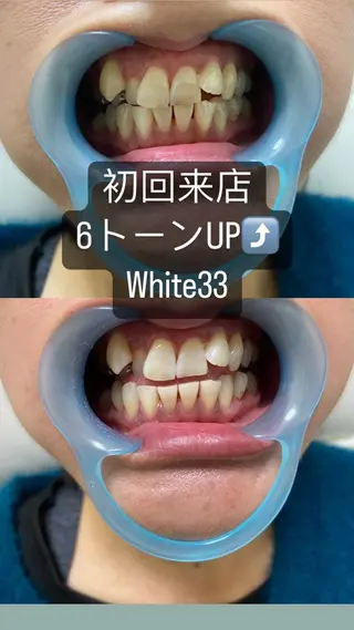 メンズ セルフホワイトニング White33大名のその他イメージ