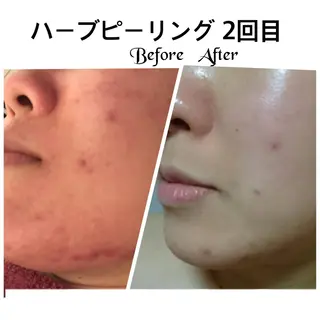 FLEUR大阪・美容 整体・痩身・小顔のエステ・リラクイメージ