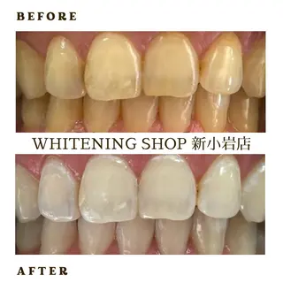 メンズ ホワイトニング ショップ新小岩店のその他イメージ