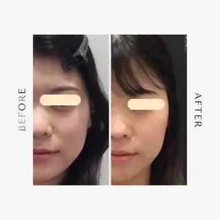 最速小顔・肌質管理 ❣️エスポワールのエステ・リラクイメージ