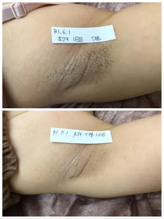 Prima〜プリマ〜 名古屋駅店所属・Prima 痩身脱毛 にごうかおりのエステ・リラクイメージ