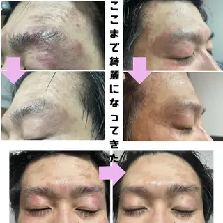 肌質改善専門店/絹々(きぬ)所属・心満たされる ハーブピーリング絹々のエステ・リラクイメージ