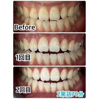 プラチナムビューティー柏所属・【歯科提携】柏ホワイ トニングスタイルのその他イメージ