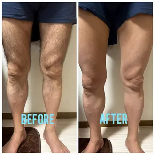 メンズ メンズ脱毛サロン shavys所属・shavys せいじのエステ・リラクイメージ