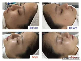 子宮矯正/腸揉み/ シュガーリング脱毛のエステ・リラクイメージ