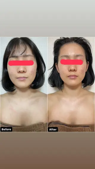 透明感の肌Lino malieのエステ・リラクイメージ