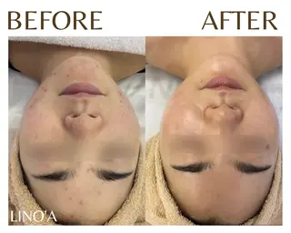 Salon💫 Lino'a柏店のエステ・リラクイメージ