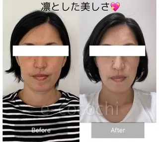 小顔と ヘッドスパのお店のエステ・リラクイメージ