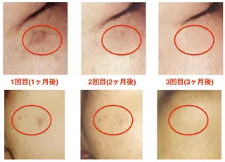 NATURE所属・菅沼 奈津子のエステ・リラクイメージ