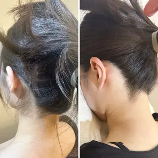 うなじ脱毛/美肌脱毛 LABELのエステ・リラクイメージ