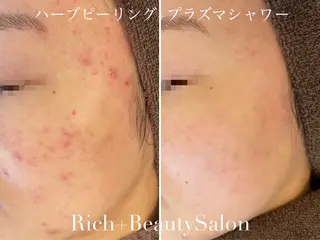Rich+ ビューティーサロンのエステ・リラクイメージ