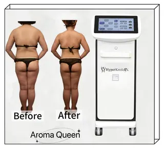 アロマクイーン所属・所沢痩身小顔コルギ AromaQueenのエステ・リラクイメージ
