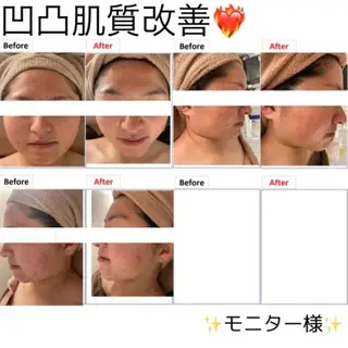 トータル美容 RAYVIS札幌店のエステ・リラクイメージ