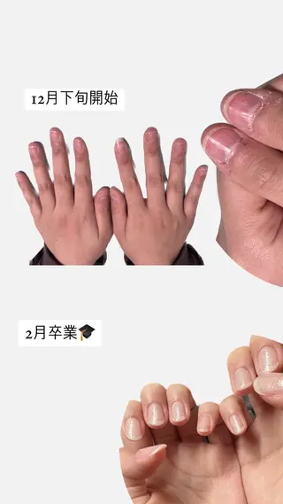 メンズ ネイル 爪ケア/深爪 自爪育成 🐰えむのネイルデザイン