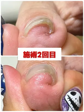 ネイル nail salon -TOIRO-所属・-TOIRO- Eriのネイルデザイン