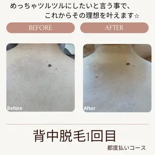 VANILLA SKY所属・VANILLA SKYのエステ・リラクイメージ