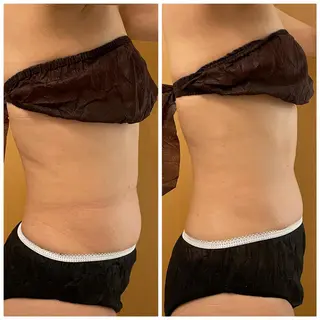 ✨美肌水光✨ アトリエリュバンのエステ・リラクイメージ