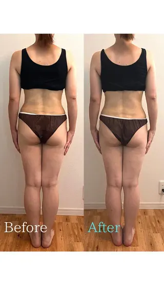 彫刻リンパ/骨盤ケア マヌティーズのその他イメージ