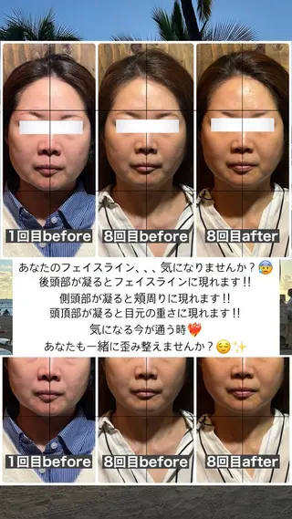 💎後悔させない小顔 矯正💎イトヤマ🌱のエステ・リラクイメージ