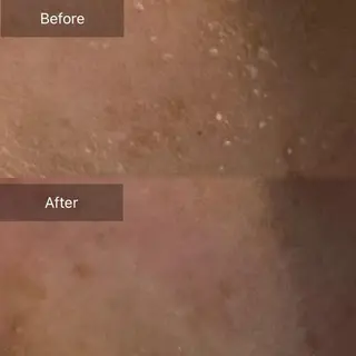 Mandarin Orange所属・毛穴から始める肌メン テマンダリンオレンジのエステ・リラクイメージ