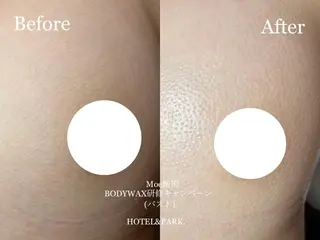 HOTEL&PARK . ワックス脱毛のエステ・リラクイメージ