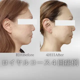 看護師 AYUIのエステ・リラクイメージ