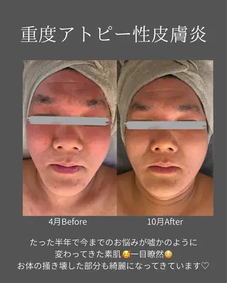 BLOSSOM 菊地のエステ・リラクイメージ