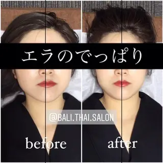 🌈歪み改善🌈 バリンタイ すぎうらのエステ・リラクイメージ