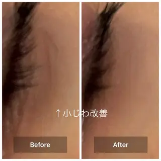 目元・まつパ・美肌フ ェイシャル谷町四丁目のマツエク・マツパデザイン