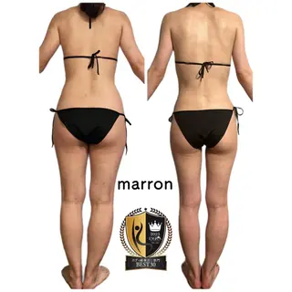 marron所属・痩身ハイパーナイフ ララピールリアボーテのエステ・リラクイメージ