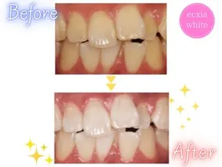 ホワイトニング エクシア横浜駅西口店のその他イメージ