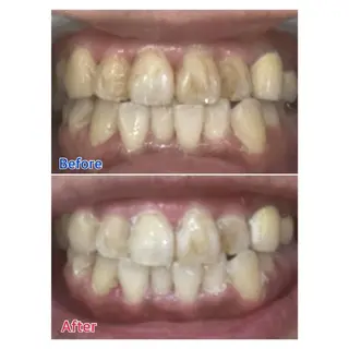 MBEAUTYSALON 千葉店・京成大久保所属・Melty 輝のその他イメージ