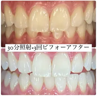 PLATINUM Beauty 横浜店所属・ホワイトニングルーム 横浜店のその他イメージ