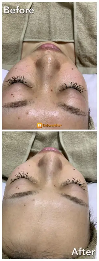 リラクゼーションエステサロン🌺肌質改善イアリイ所属・肌質再生 〜イア🌺リイ〜のエステ・リラクイメージ