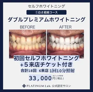 メンズ キッズ ネイル マツエク・マツパ アイブロウ プラチナムビューティー柏所属・【歯科提携】柏ホワイ トニングスタイルのその他イメージ