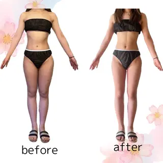 YOSAPARK Leapのエステ・リラクイメージ