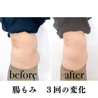 美容姿勢整体Cinq所属・𝐂𝐢𝐧𝐪🎗 腸もみ｜美容整体のエステ・リラクイメージ
