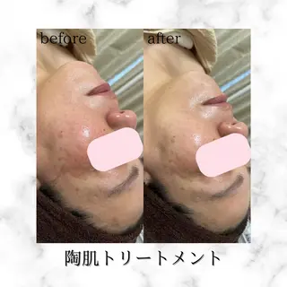 ミディアム カラー パーマ ヘアアレンジ メンズ キッズ ネイル マツエク・マツパ アイブロウ Amaryllis 🌹松本のエステ・リラクイメージ