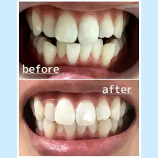 お手軽ホワイトニングsalon mina所属・武元 奈津美のその他イメージ