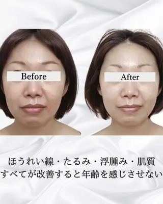 看護師 AYUIのエステ・リラクイメージ