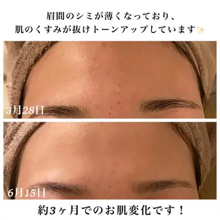 Bellesthe (ベルエステ)のエステ・リラクイメージ