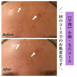 Bellesthe (ベルエステ)のエステ・リラクイメージ