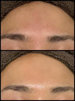 Lumiere despoir所属・Lumiere despoirのエステ・リラクイメージ