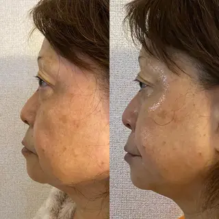 Meetite 小林のエステ・リラクイメージ