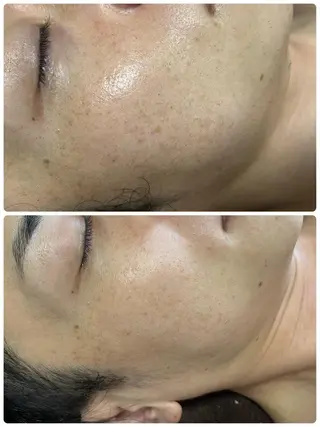 SALON BioBioのエステ・リラクイメージ