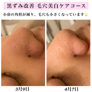 Bellesthe (ベルエステ)のエステ・リラクイメージ