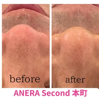 ANERA Second所属・尾上 沙織のエステ・リラクイメージ