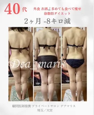 private salon  Dea_maris シュガーリング＆パーソナルボディケア所属・ダイエット難民が通う 10キロダイエットのその他イメージ